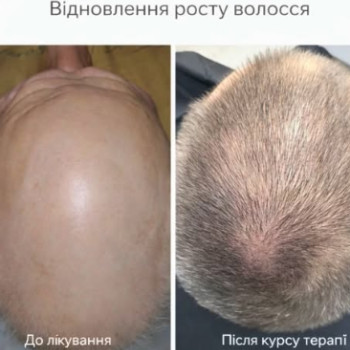 Фото с портфолио Центр Красоты и Здоровья Волос
