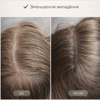 Фото с портфолио Центр Красоты и Здоровья Волос
