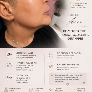Фото с портфолио Екатерина Стельмашенко