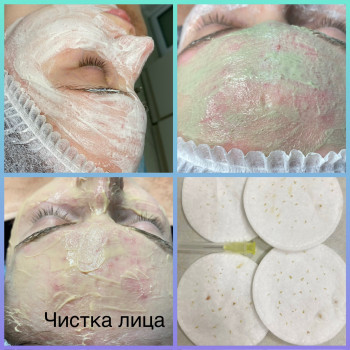 Механічна Чистка обличчя