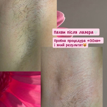 Фото с портфолио Ліза Ляхович
