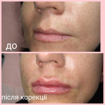 Фото с портфолио Анастасия Лазоренко