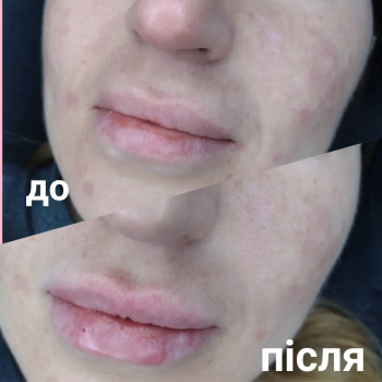 Фото с портфолио Анастасия Лазоренко