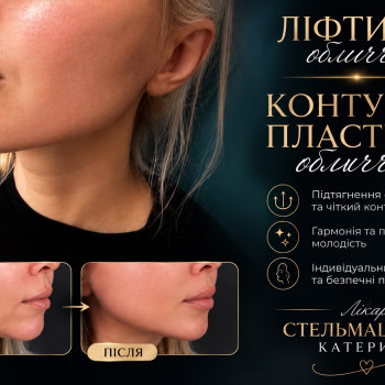 Фото с портфолио Екатерина Стельмашенко