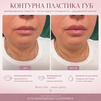 Фото с портфолио Екатерина Стельмашенко
