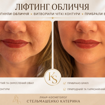 Фото с портфолио Екатерина Стельмашенко