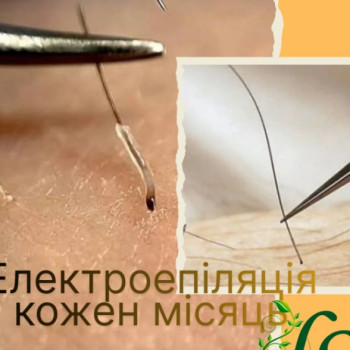 Фото с портфолио LaserSmooth studio