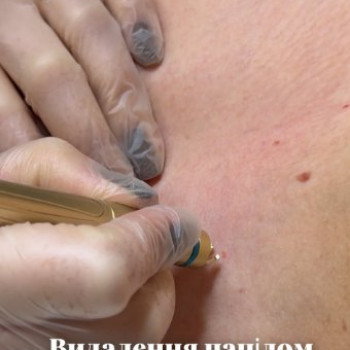 Фото с портфолио Laser Room