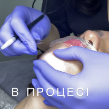 Фото с портфолио Laser Room