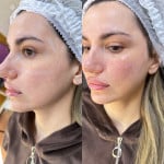 Facetem S Косметолог-ін'єкціоніст Любов Дніпро