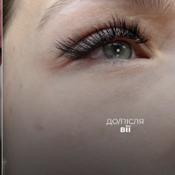 Фото с портфолио Tiara