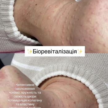 Фото с портфолио Анастасiя Клiценко