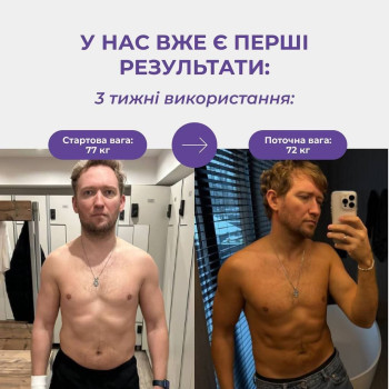Фото с портфолио KissCosmetology