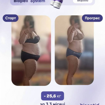 Фото с портфолио KissCosmetology