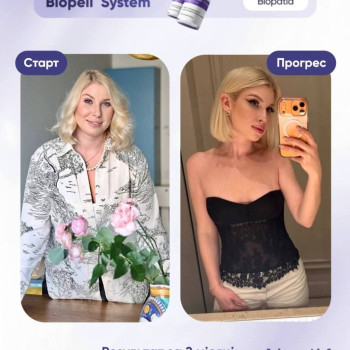 Фото с портфолио KissCosmetology