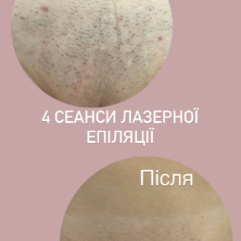 Фото с портфолио Тетяна Кунинець