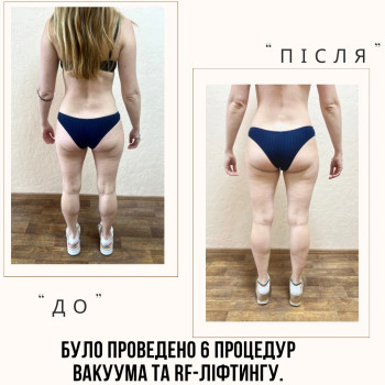 Фото с портфолио Альона Селянко