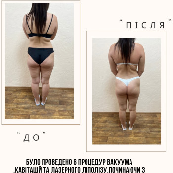 Фото с портфолио Альона Селянко