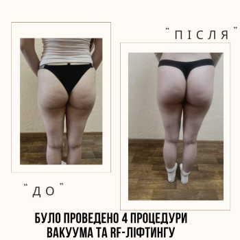Фото с портфолио Альона Селянко