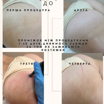 Фото с портфолио Альона Селянко