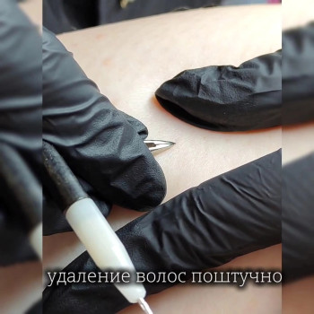 Електроепіляція видаляе навіть світле волосся! Професійна процедура у студії Майї Філатової.