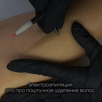 Хочите гладеньку шкіру без небажаного волосся?Студія косметолагії та електроепіляції Майї Філатової - це Ваша студія!