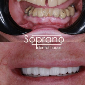 Фото с портфолио Soprano