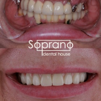 Фото с портфолио Soprano