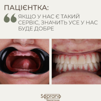 Фото с портфолио Soprano