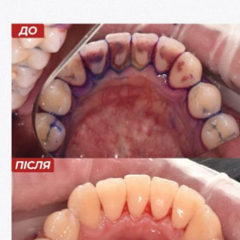 Фото с портфолио МістоДент