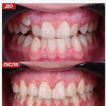 Фото с портфолио МістоДент