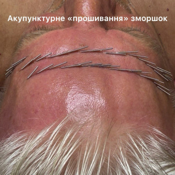 Фото с портфолио Тетяна Павлишена