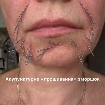 Фото с портфолио Тетяна Павлишена