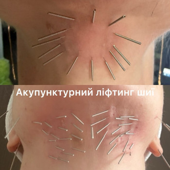 Фото с портфолио Тетяна Павлишена