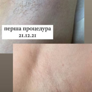 Фото с портфолио Іванна Кмець