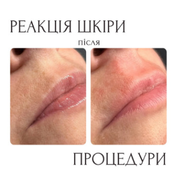 Фото с портфолио Надія Ковальчик