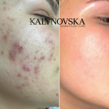Фото с портфолио Валентина Калиновская