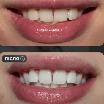 Фото с портфолио Ярослав Пішковці
