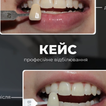 Фото с портфолио Ярослав Пішковці