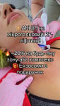 Знижка 20% на мікроголковий RF-ліфтинг ! Косметология Perfect Skin Киев