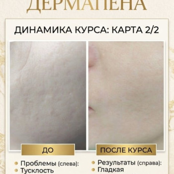 Фото с портфолио Любовь Черней