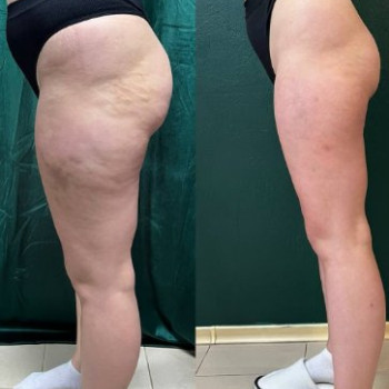 Фото с портфолио Body Balance