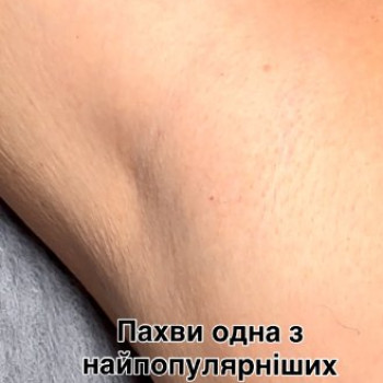 Фото с портфолио Epil Estetic