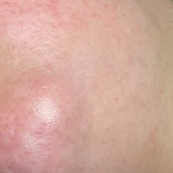 Фото с портфолио Epil Estetic