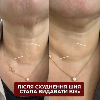 Фото с портфолио Лілія Смірнова