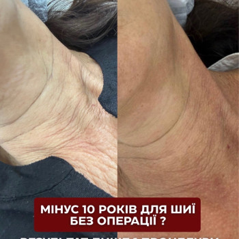 Фото с портфолио Лілія Смірнова