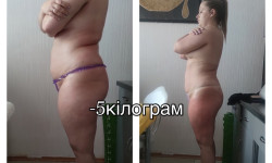 Системная программа для похудения «новая я» Косметолог-естетист Карина Дніпро