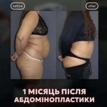 Фото с портфолио Patlazhan Clinic