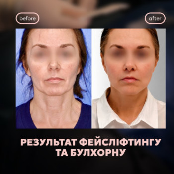 Фото с портфолио Patlazhan Clinic