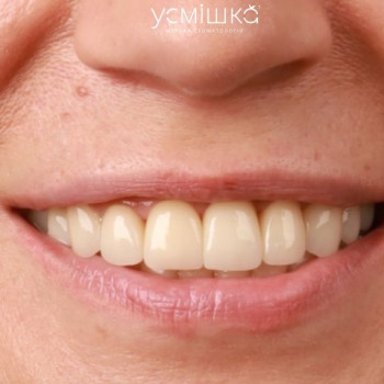 Фото с портфолио Усмішка